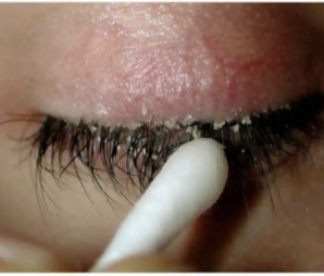 eyelash-particles