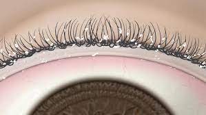 eyelash-particles